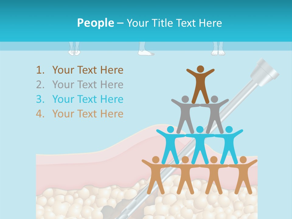 Illustration Of Liposuction Intervention With Liposculpture In A Woman PowerPoint Template