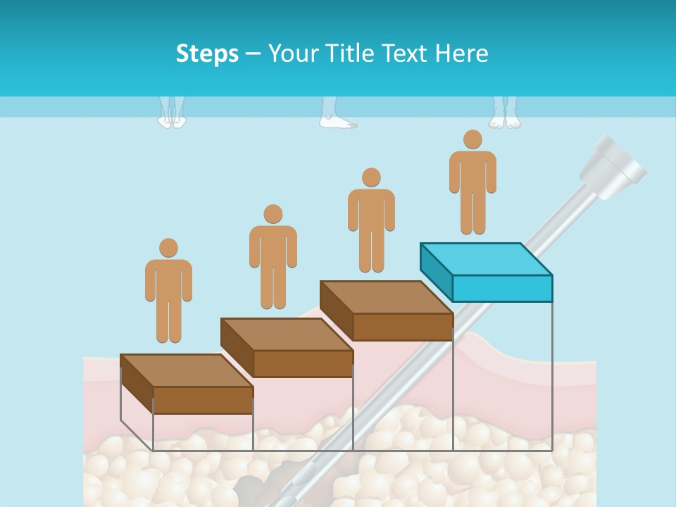 Illustration Of Liposuction Intervention With Liposculpture In A Woman PowerPoint Template