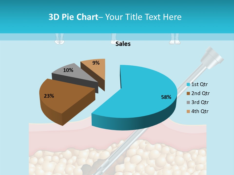 Illustration Of Liposuction Intervention With Liposculpture In A Woman PowerPoint Template
