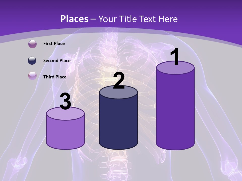 Backache PowerPoint Template