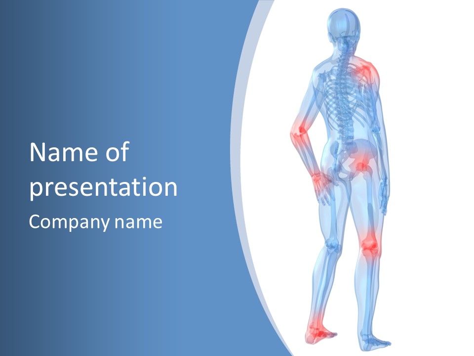 Painful Joints PowerPoint Template