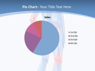 Painful Joints PowerPoint Template