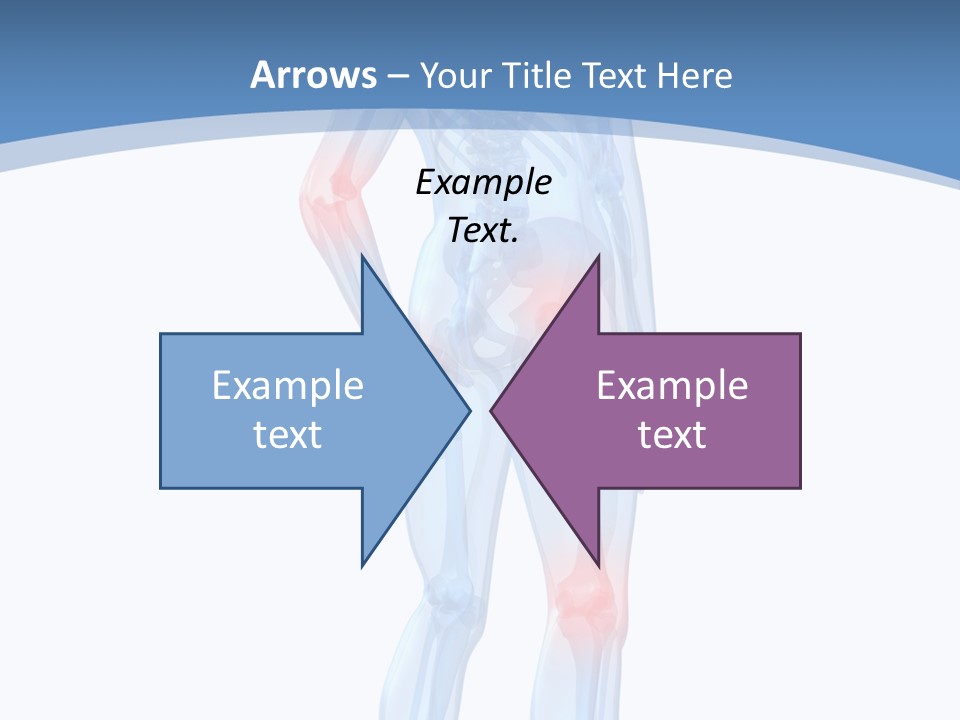 Painful Joints PowerPoint Template