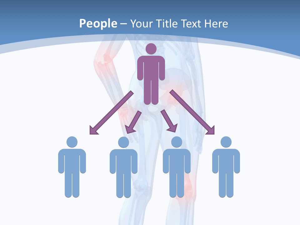 Painful Joints PowerPoint Template
