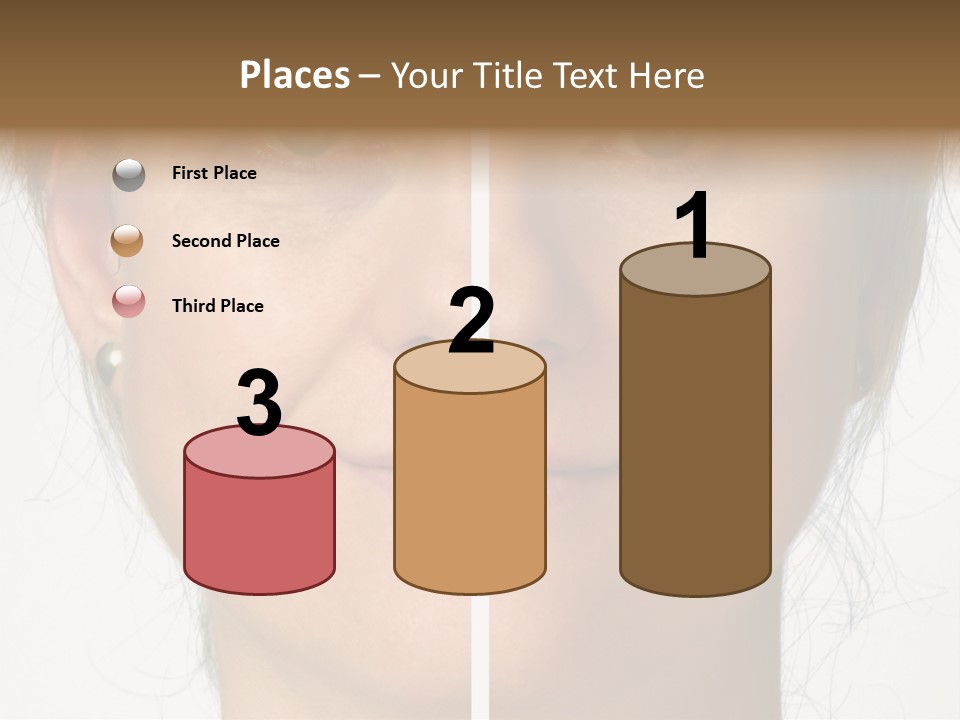A Woman's Face Before And After A Cosmetic Procedure PowerPoint Template