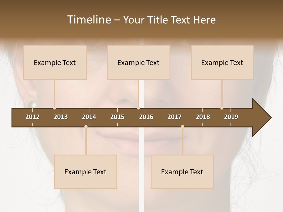 A Woman's Face Before And After A Cosmetic Procedure PowerPoint Template