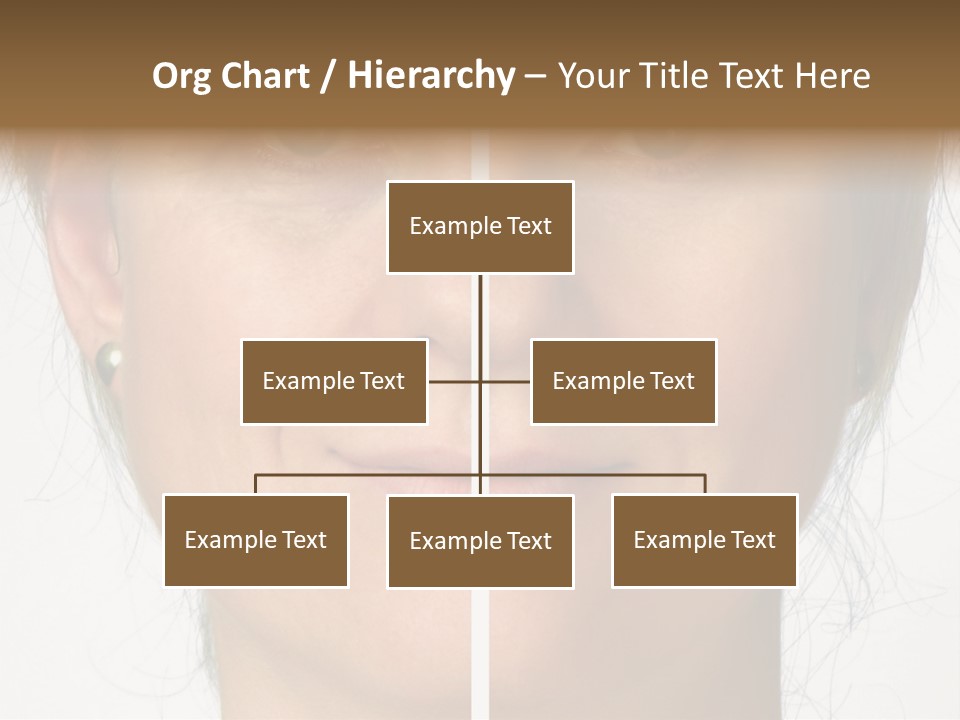 A Woman's Face Before And After A Cosmetic Procedure PowerPoint Template