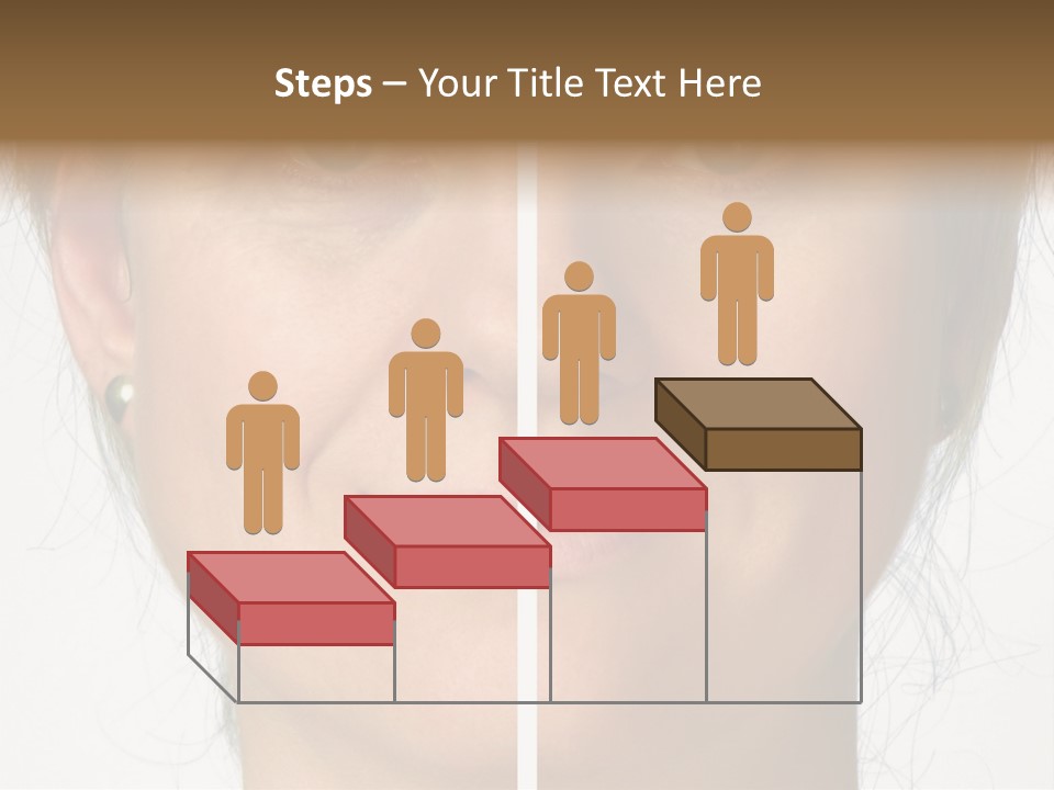 A Woman's Face Before And After A Cosmetic Procedure PowerPoint Template