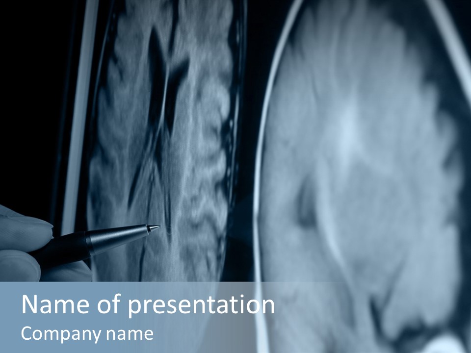 Pen Showing X-Ray Pictures Of Brain On Screen PowerPoint Template