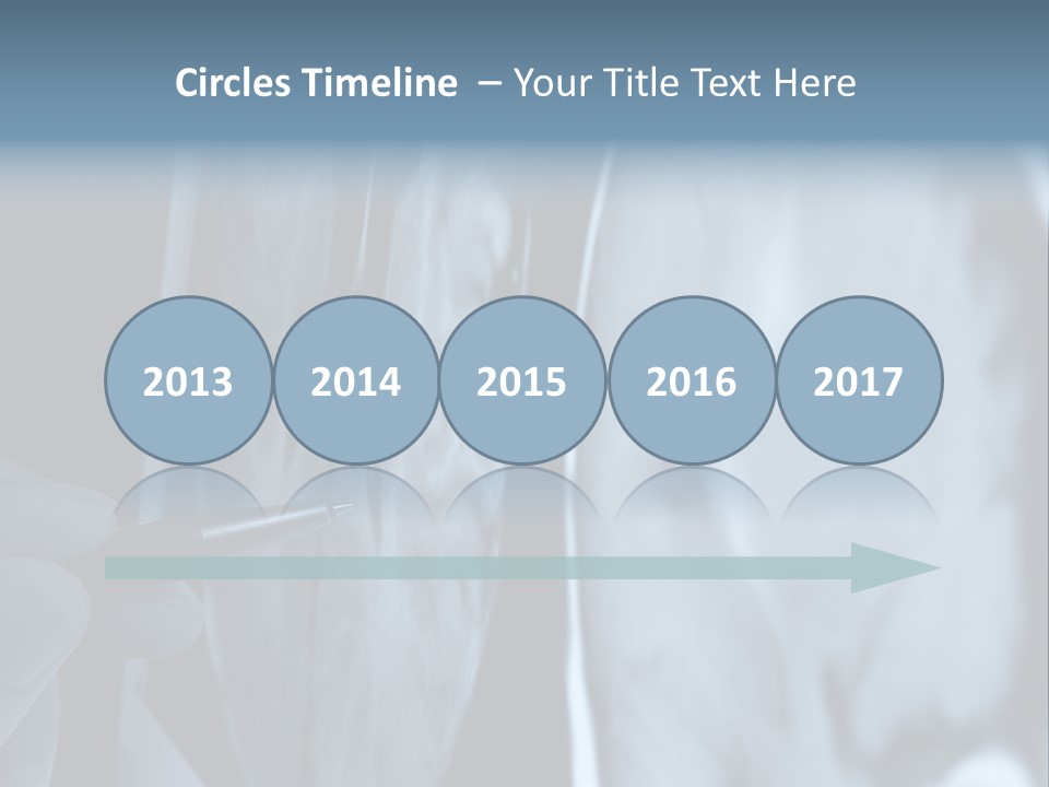 Pen Showing X-Ray Pictures Of Brain On Screen PowerPoint Template