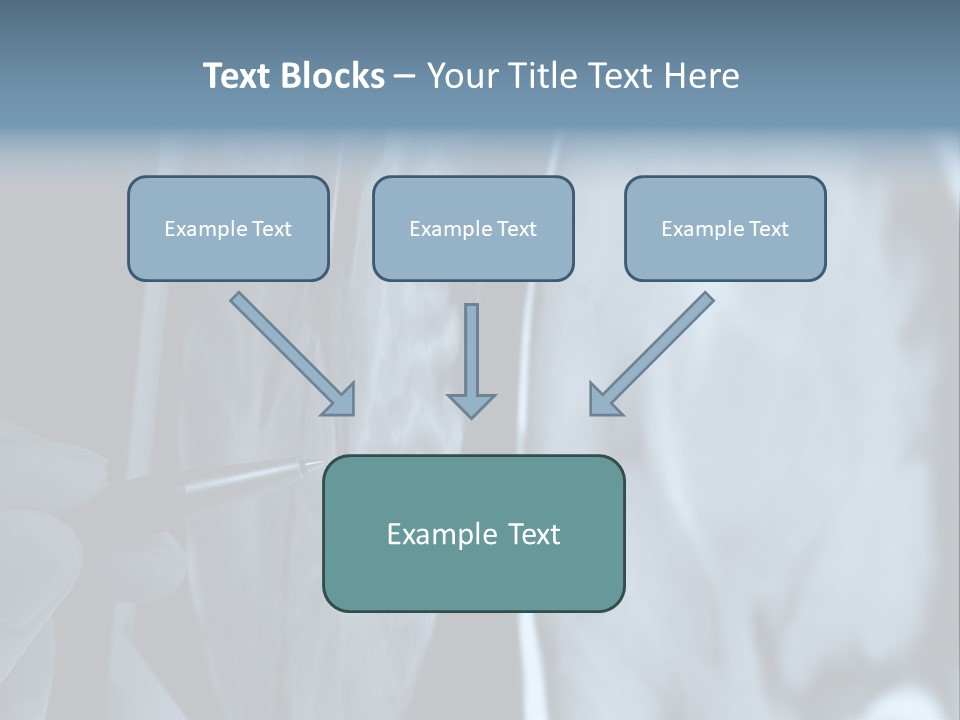Pen Showing X-Ray Pictures Of Brain On Screen PowerPoint Template