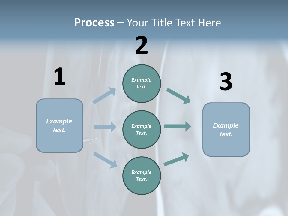 Pen Showing X-Ray Pictures Of Brain On Screen PowerPoint Template