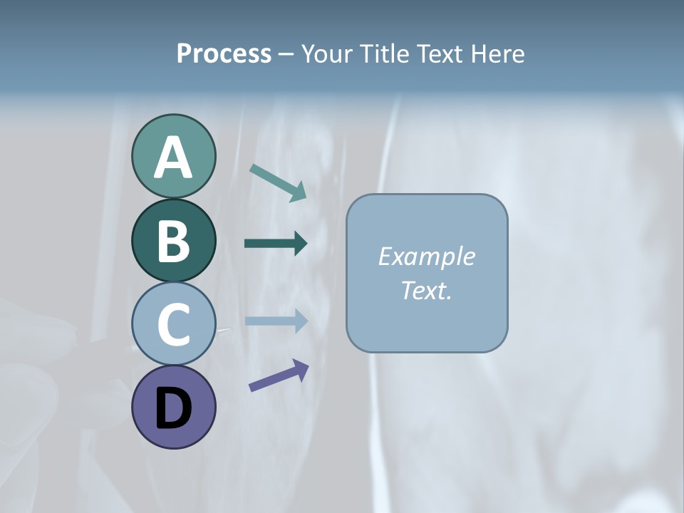 Pen Showing X-Ray Pictures Of Brain On Screen PowerPoint Template