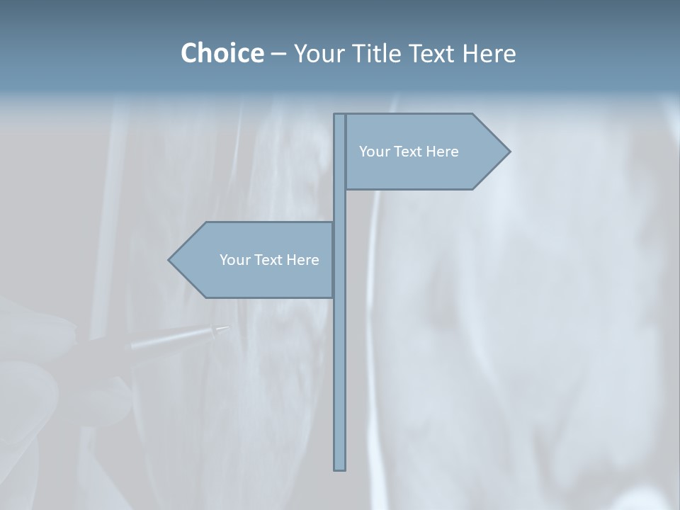 Pen Showing X-Ray Pictures Of Brain On Screen PowerPoint Template