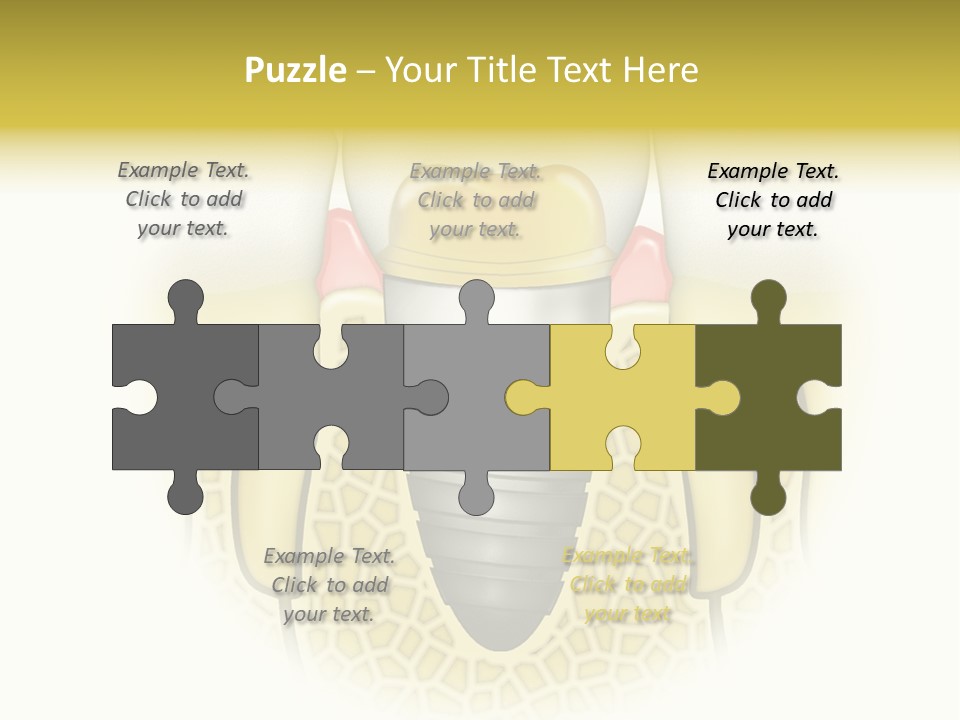A Tooth With A Implant In The Middle Of It PowerPoint Template