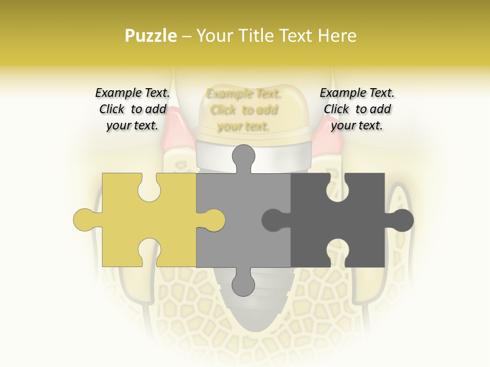 A Tooth With A Implant In The Middle Of It PowerPoint Template