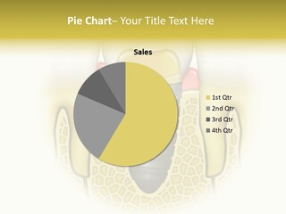 A Tooth With A Implant In The Middle Of It PowerPoint Template