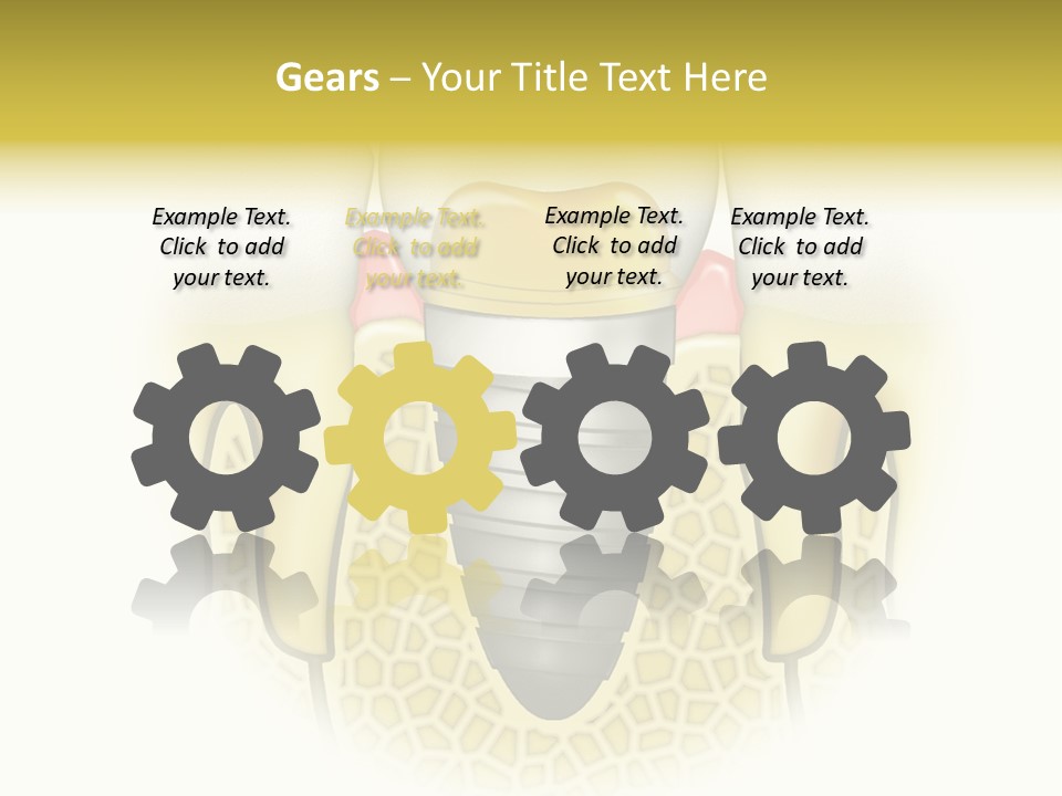 A Tooth With A Implant In The Middle Of It PowerPoint Template