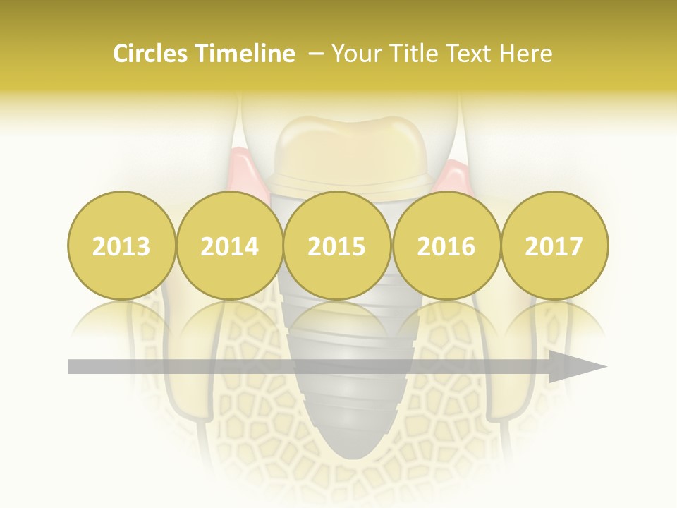 A Tooth With A Implant In The Middle Of It PowerPoint Template