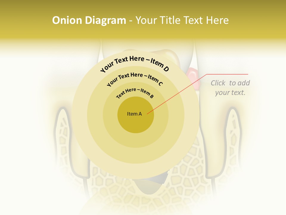A Tooth With A Implant In The Middle Of It PowerPoint Template