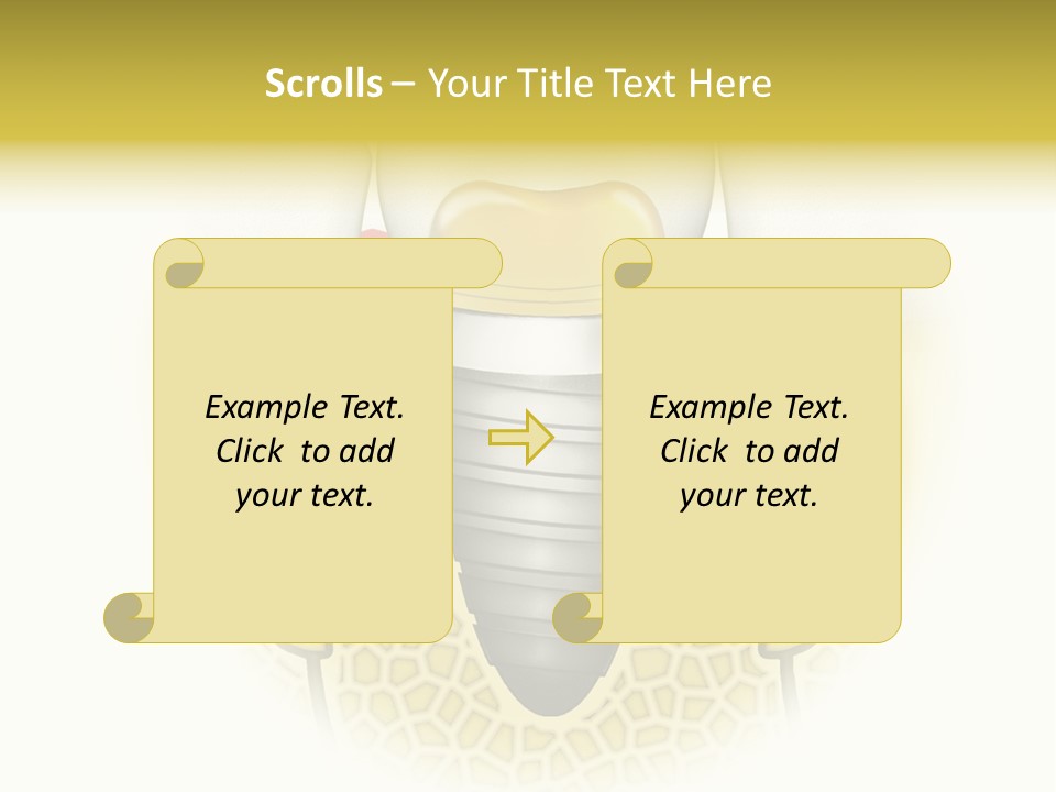 A Tooth With A Implant In The Middle Of It PowerPoint Template