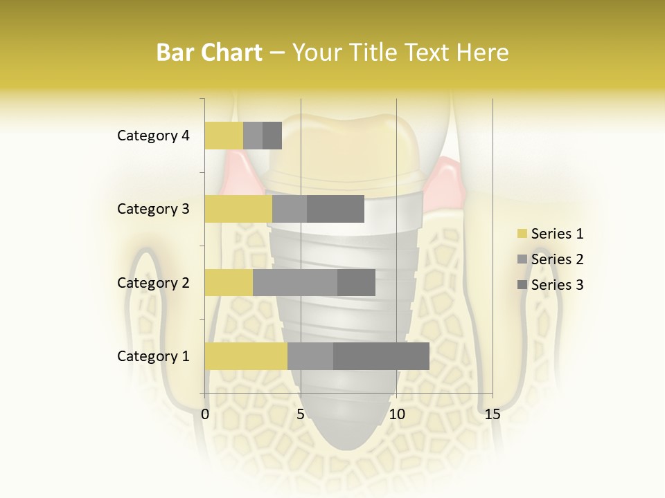 A Tooth With A Implant In The Middle Of It PowerPoint Template