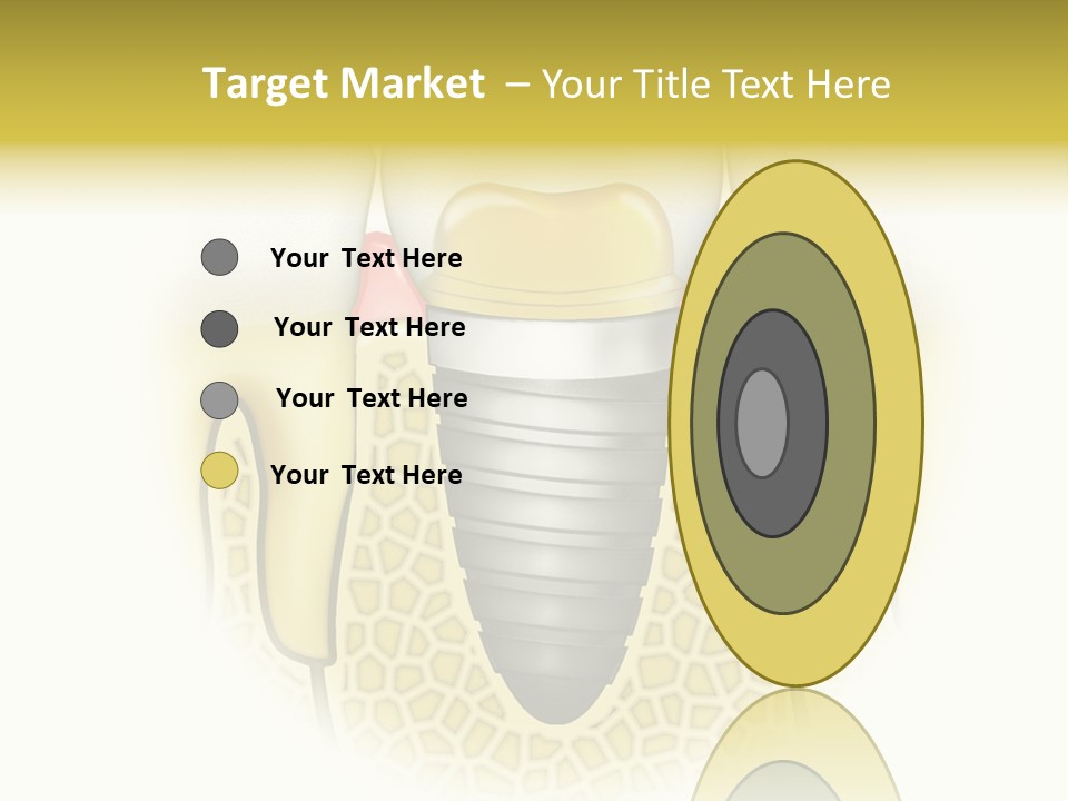A Tooth With A Implant In The Middle Of It PowerPoint Template