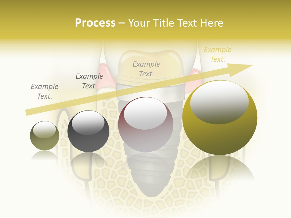 A Tooth With A Implant In The Middle Of It PowerPoint Template