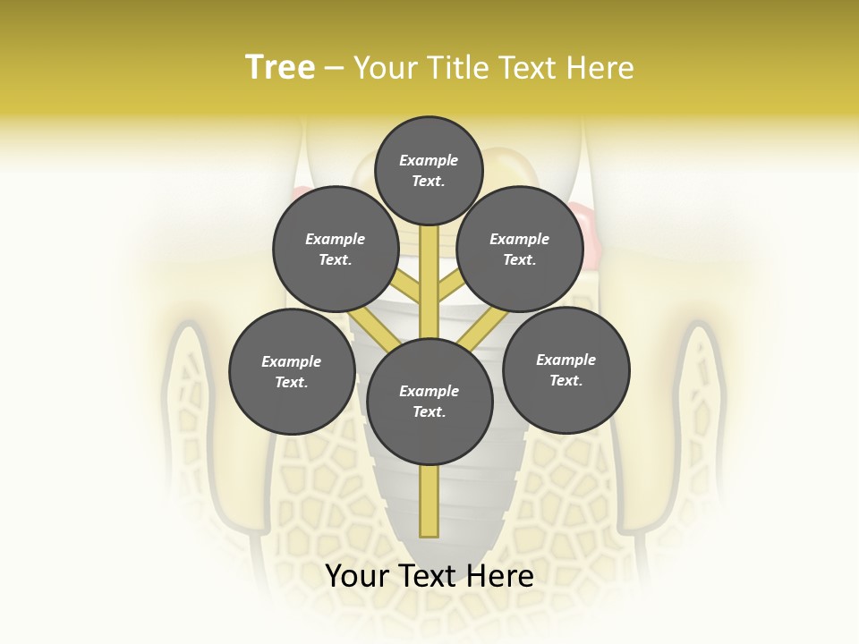 A Tooth With A Implant In The Middle Of It PowerPoint Template