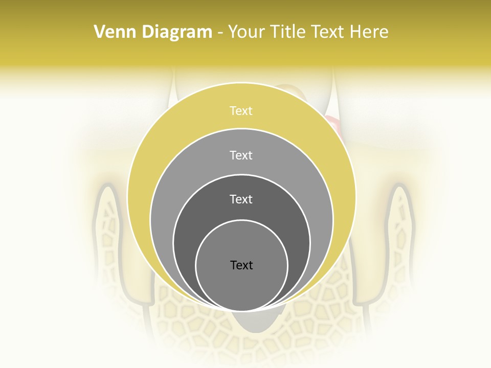 A Tooth With A Implant In The Middle Of It PowerPoint Template