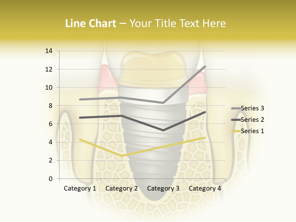 A Tooth With A Implant In The Middle Of It PowerPoint Template