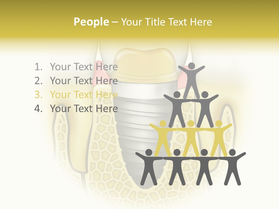 A Tooth With A Implant In The Middle Of It PowerPoint Template