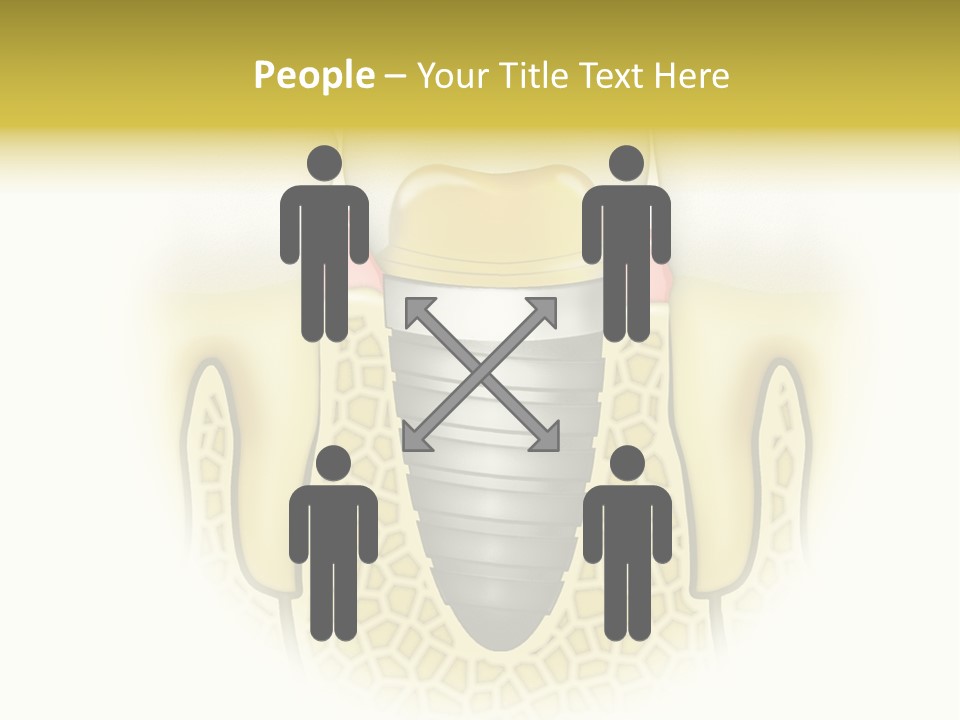 A Tooth With A Implant In The Middle Of It PowerPoint Template