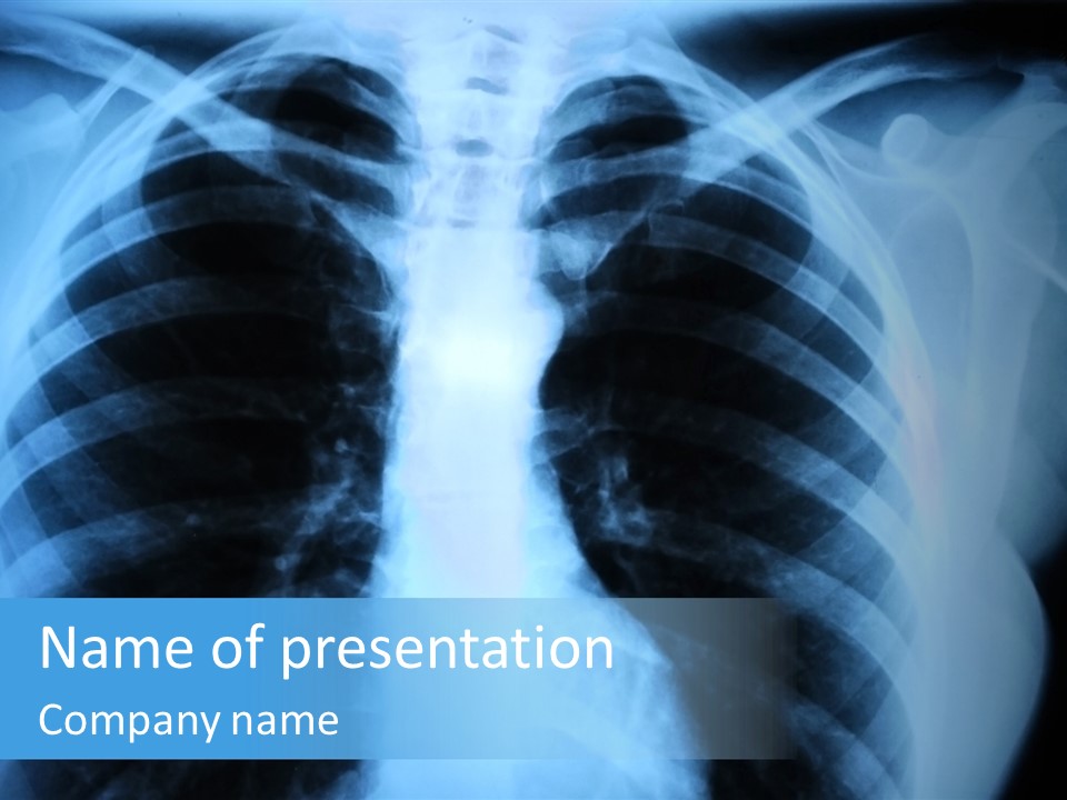 A Radiograph Of Human Body Is In Black And White Tones PowerPoint Template