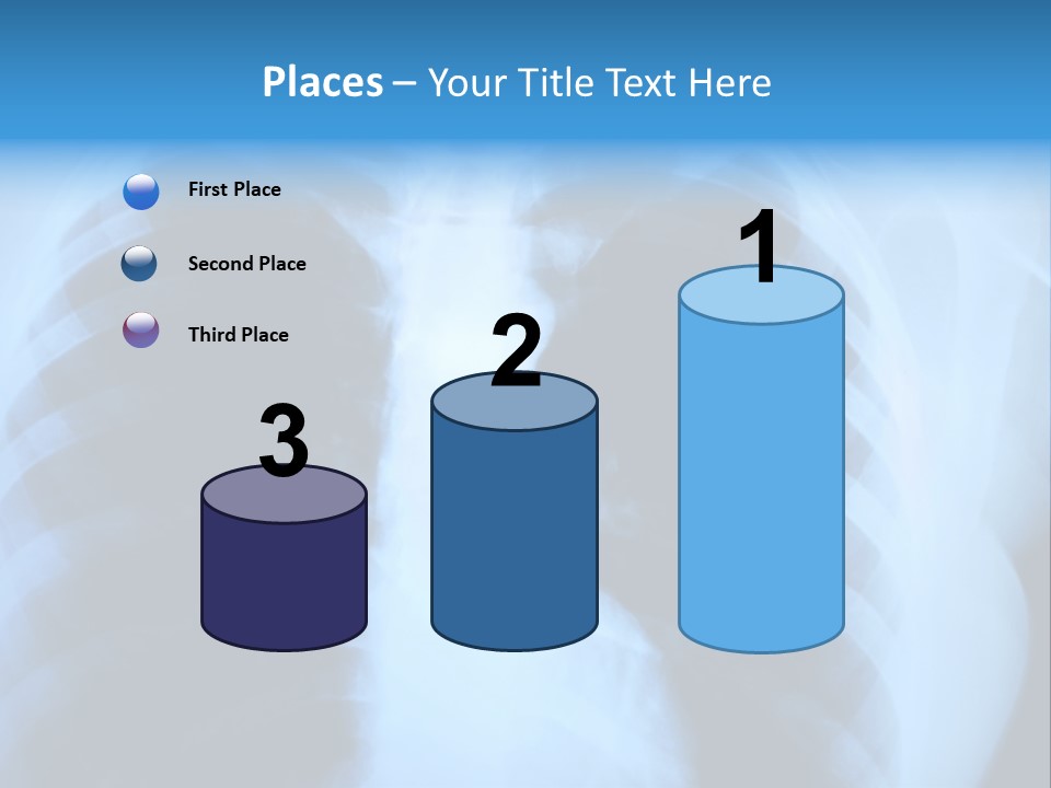 A Radiograph Of Human Body Is In Black And White Tones PowerPoint Template