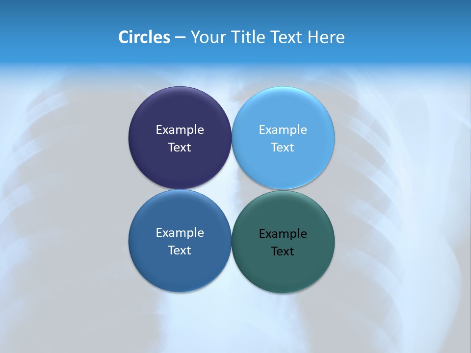 A Radiograph Of Human Body Is In Black And White Tones PowerPoint Template