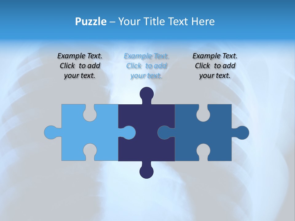 A Radiograph Of Human Body Is In Black And White Tones PowerPoint Template