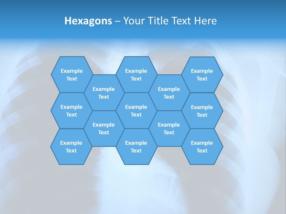 A Radiograph Of Human Body Is In Black And White Tones PowerPoint Template