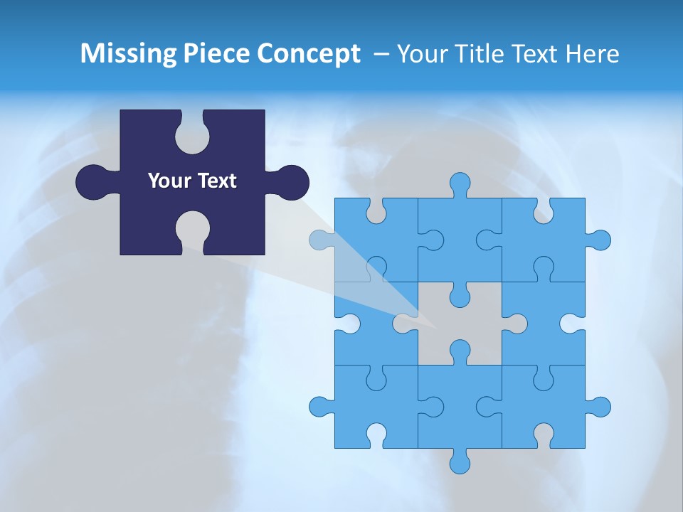 A Radiograph Of Human Body Is In Black And White Tones PowerPoint Template