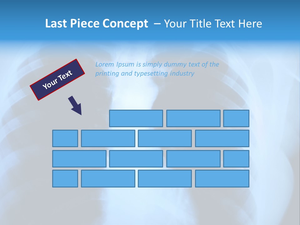 A Radiograph Of Human Body Is In Black And White Tones PowerPoint Template