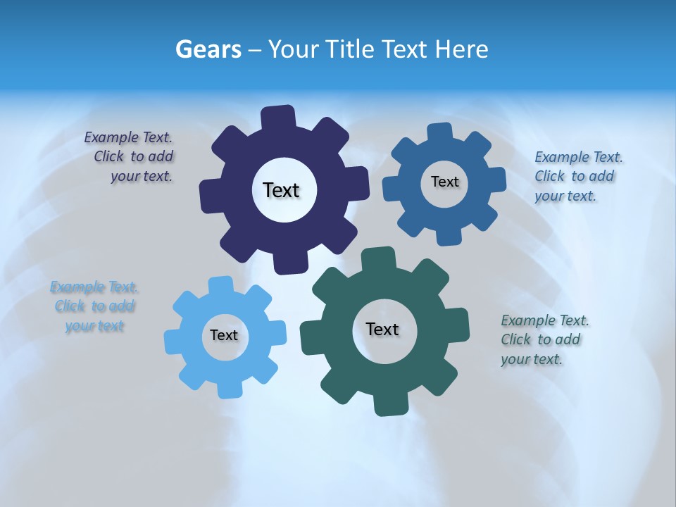A Radiograph Of Human Body Is In Black And White Tones PowerPoint Template