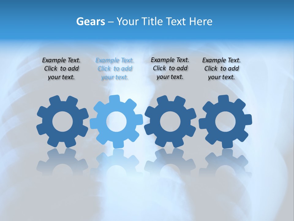 A Radiograph Of Human Body Is In Black And White Tones PowerPoint Template