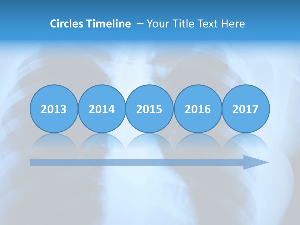 A Radiograph Of Human Body Is In Black And White Tones PowerPoint Template