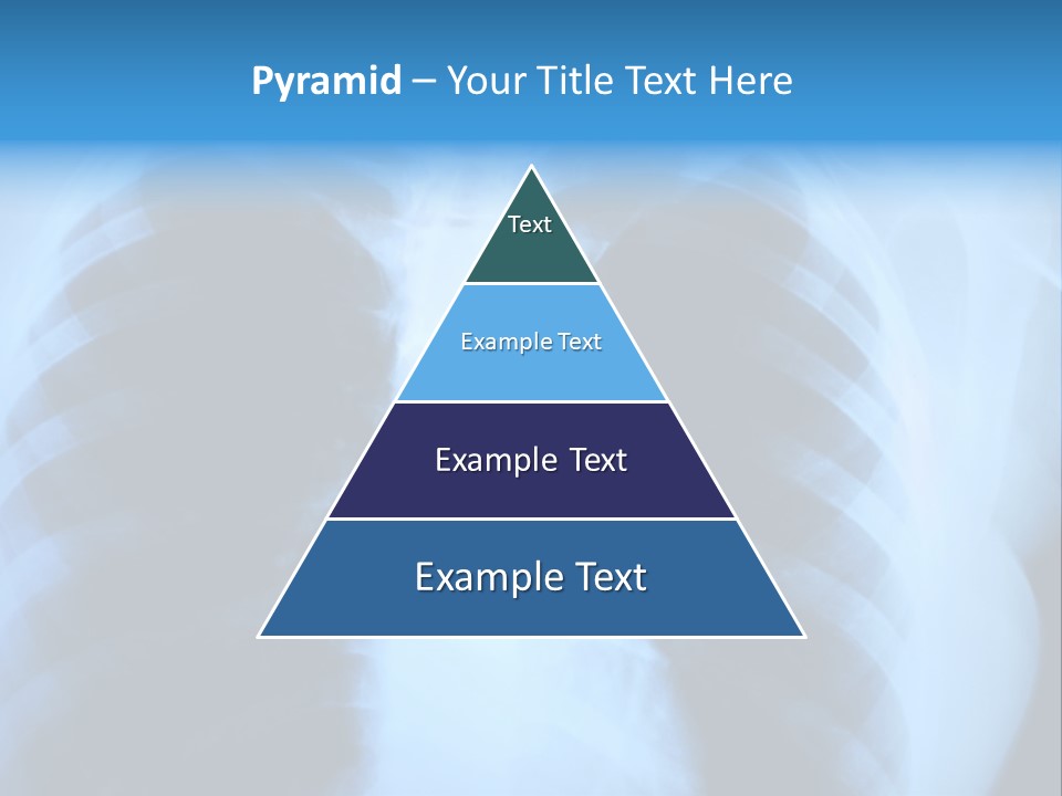 A Radiograph Of Human Body Is In Black And White Tones PowerPoint Template
