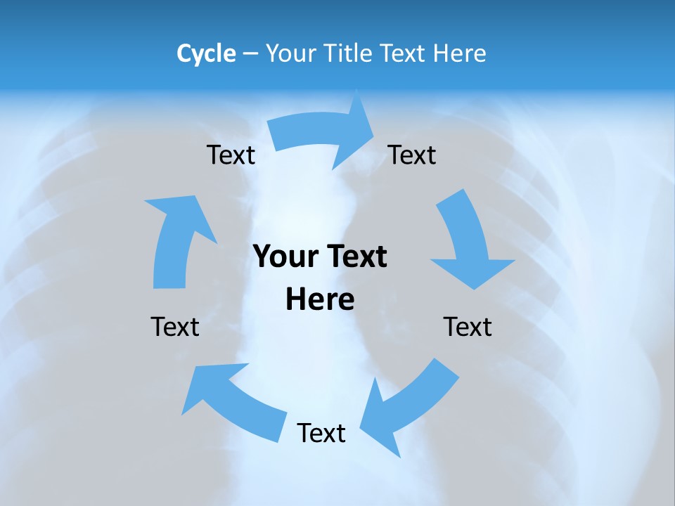 A Radiograph Of Human Body Is In Black And White Tones PowerPoint Template