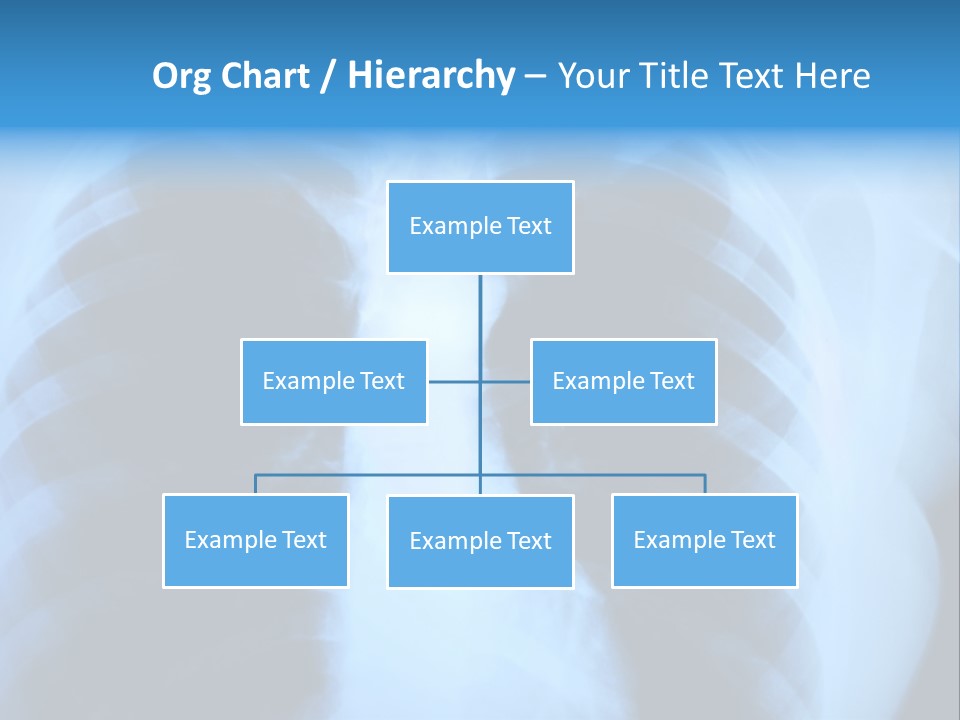 A Radiograph Of Human Body Is In Black And White Tones PowerPoint Template