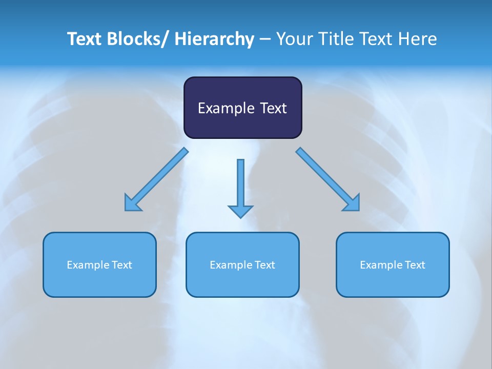 A Radiograph Of Human Body Is In Black And White Tones PowerPoint Template