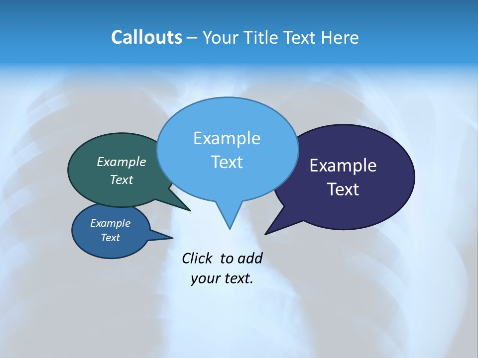 A Radiograph Of Human Body Is In Black And White Tones PowerPoint Template