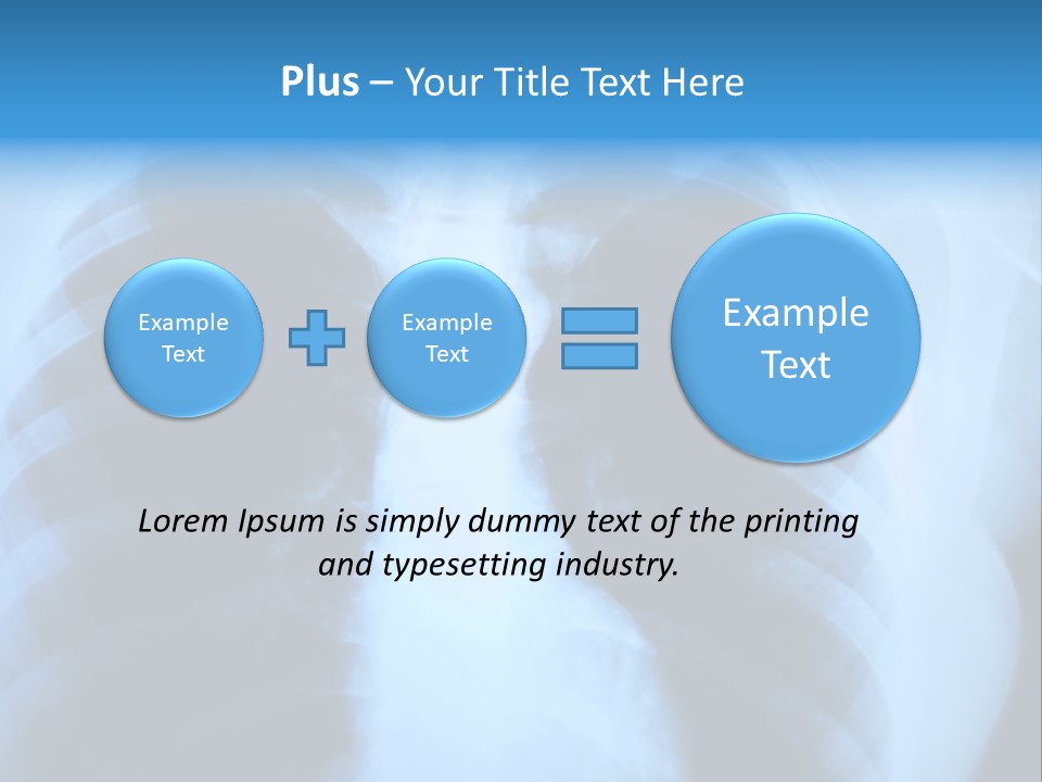 A Radiograph Of Human Body Is In Black And White Tones PowerPoint Template
