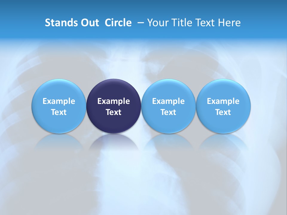 A Radiograph Of Human Body Is In Black And White Tones PowerPoint Template